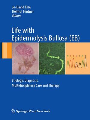 cover image of Life with Epidermolysis Bullosa (EB)